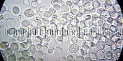 Image: Bob Blaylock, Saccharomyces cerevisiae — baker's yeast, Wikimedia Commons, Creative Commons Attribution-Share Alike 3.0 Unported