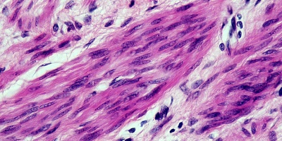 Image: Berkshire Community College Bioscience Image Library, cross section: smooth muscle magnification: 400x, Wikimedia Commons, Creative Commons CC0 1.0 Universal Public Domain Dedication
