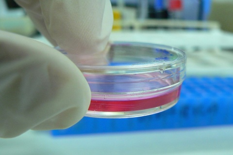 Image: kaibara87, Cell Culture in a tiny Petri dish, Wikimedia Commons, Creative Commons Attribution 2.0 Generic