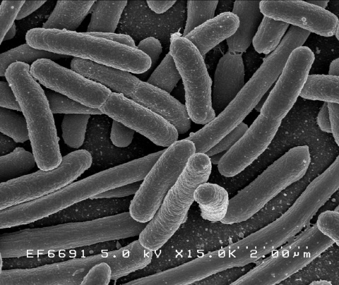 Image: NIAID, E. coli bacteria, Flickr, Creative Commons Attribution 2.0 Generic