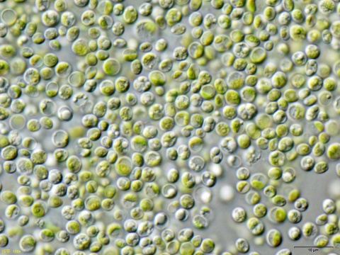 Image: NEON_ja, Chlorella vulgaris Beijerinck NIES-2170 / Olympus IX71+DP72, Wikimedia Commons, Creative Commons Attribution-Share Alike 3.0 Unported