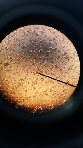 Image: Sam LaRussa, Yeast Cells Under the Microscope, Flickr, Creative Commons Attribution 2.0 Generic