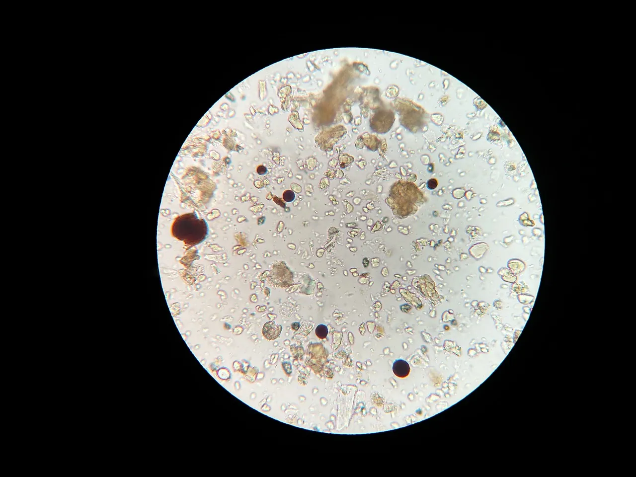 Soil microbes viewed under microscope. Photo by Malucero via Pixabay.