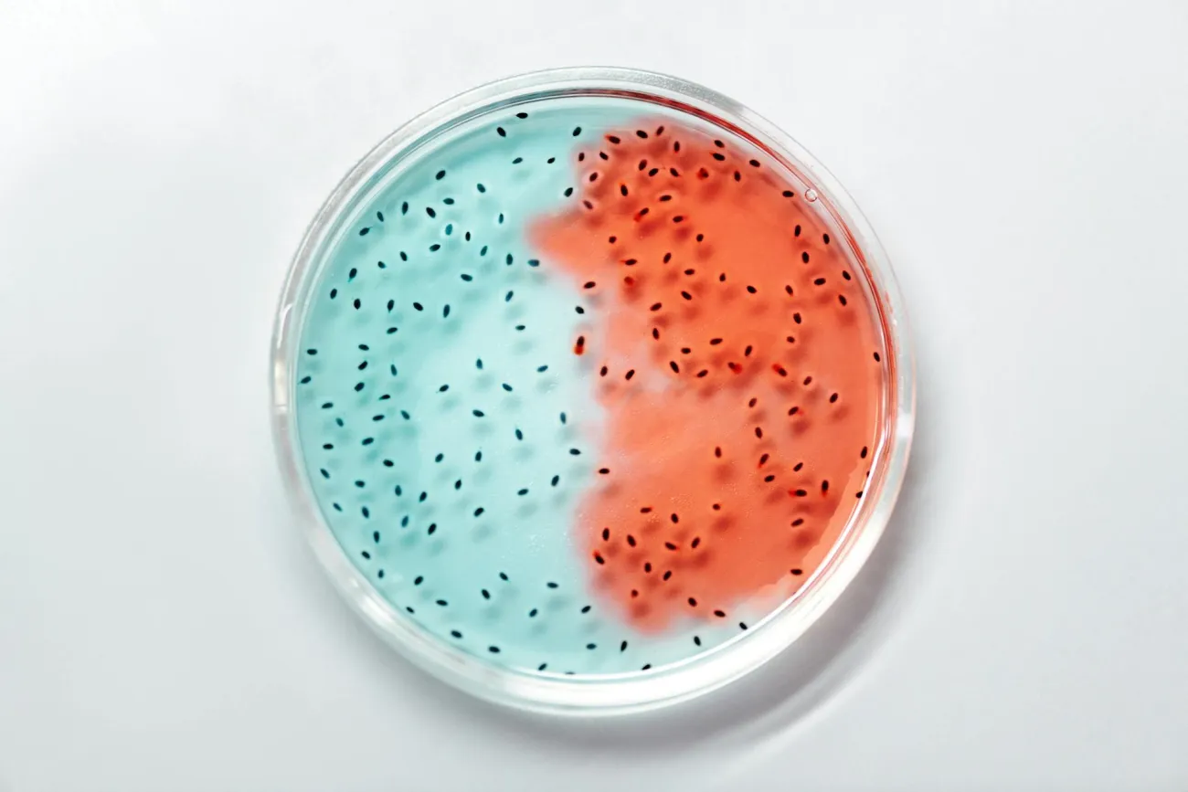 Petridish. Credit: Edward Jenner via Pexels