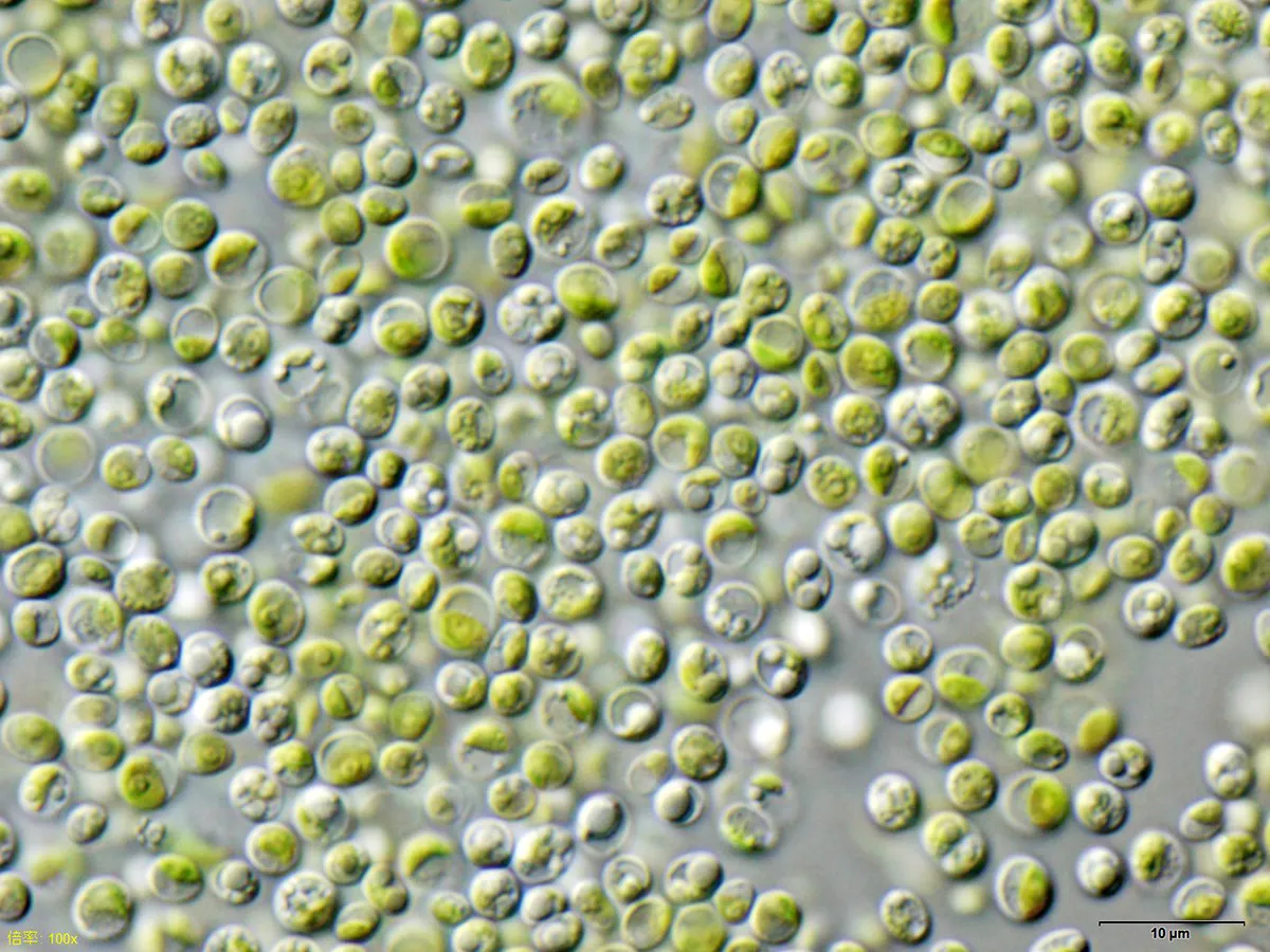 Image: NEON_ja, Chlorella vulgaris Beijerinck NIES-2170 / Olympus IX71+DP72, Wikimedia Commons, Creative Commons Attribution-Share Alike 3.0 Unported