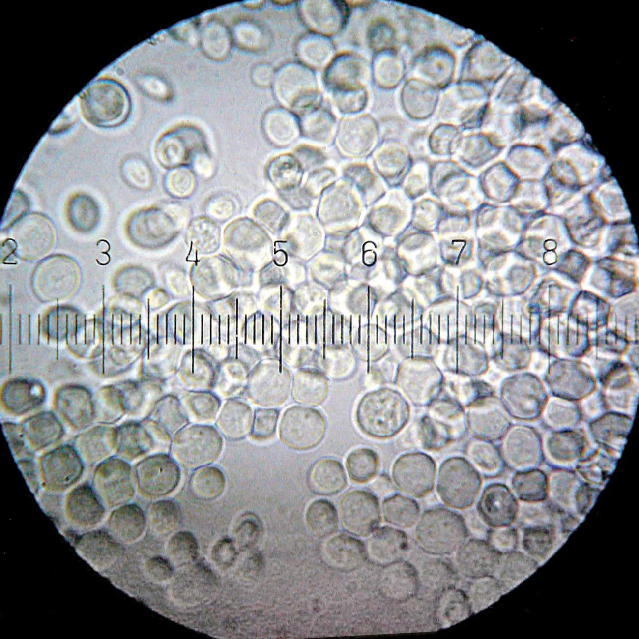 Image: Bob Blaylock, Saccharomyces cerevisiae — baker's yeast, Wikimedia Commons, Creative Commons Attribution-Share Alike 3.0 Unported