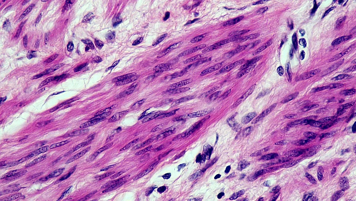 Image: Berkshire Community College Bioscience Image Library, cross section: smooth muscle magnification: 400x, Wikimedia Commons, Creative Commons CC0 1.0 Universal Public Domain Dedication