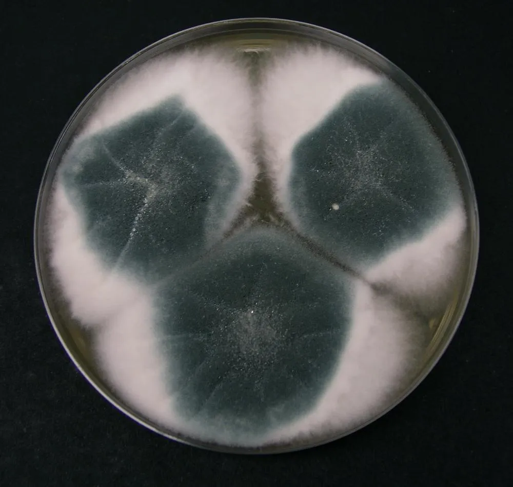Image: Dr. David Midgley, Aspergillus fumigatus from soil in culture, Wikimedia Commons, Creative Commons Attribution-Share Alike 2.5 Generic