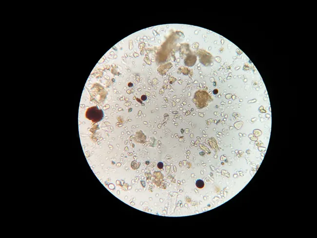 Soil microbes viewed under microscope. Photo by Malucero via Pixabay.