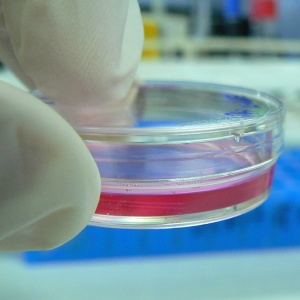 Image: kaibara87, Cell Culture in a tiny Petri dish, Wikimedia Commons, Creative Commons Attribution 2.0 Generic